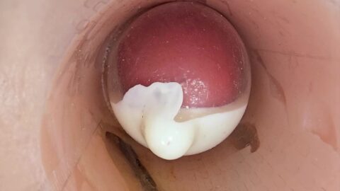 Deep In The Camera Condoms In The Camera Condoms A Huge Feeling Of Sperm